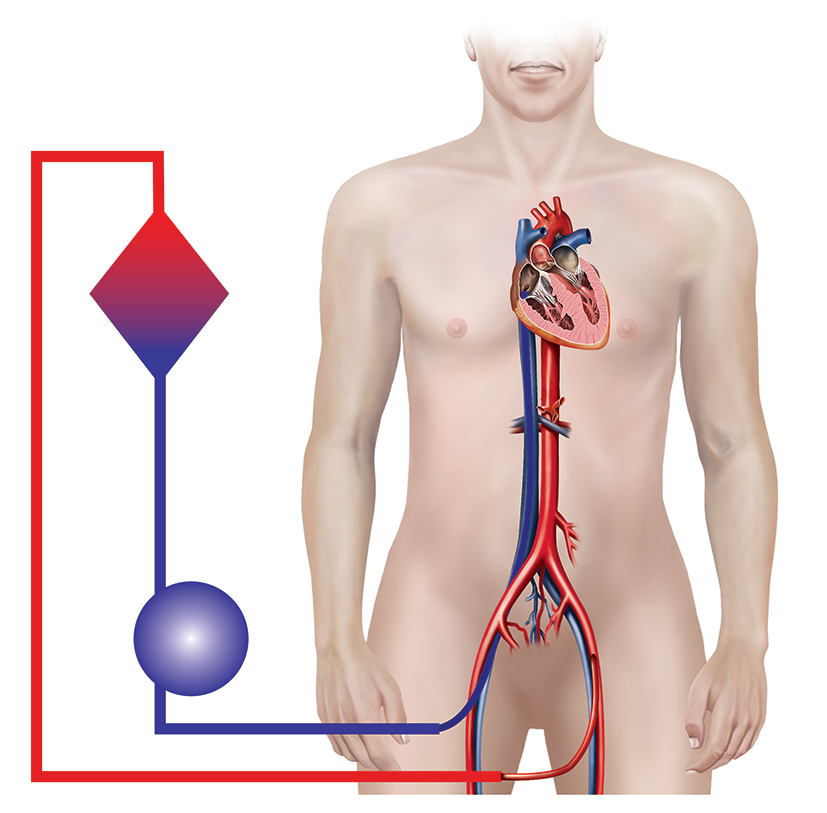 Diagram showing the veno-arterial flow used by ECMO