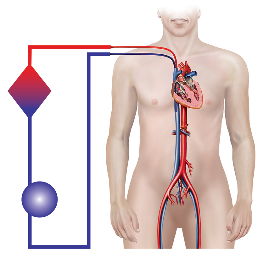 Diagram showing the veno-venous flow used by ECMO