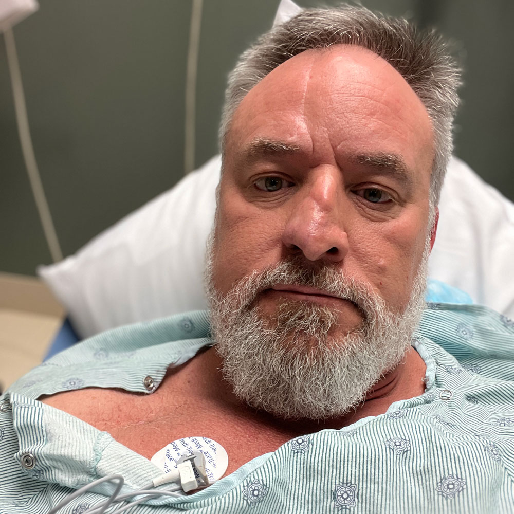 Patient Steven Tinkham's selfie wearing a hospital gown