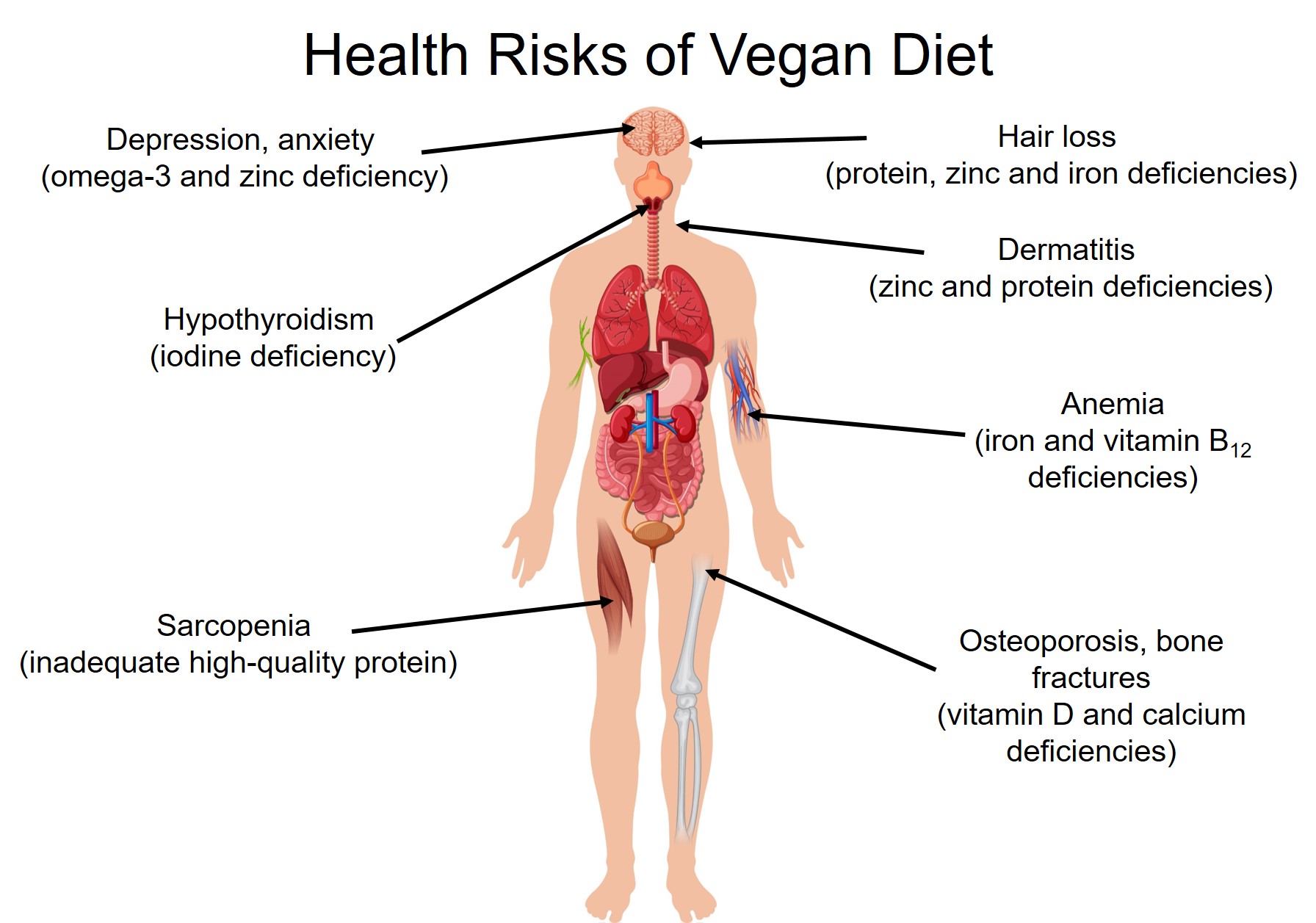 Research Shows Vegan Diet Leads to Nutritional Deficiencies, Health  Problems; Plant-Forward Omnivorous Whole Foods Diet Is Healthier