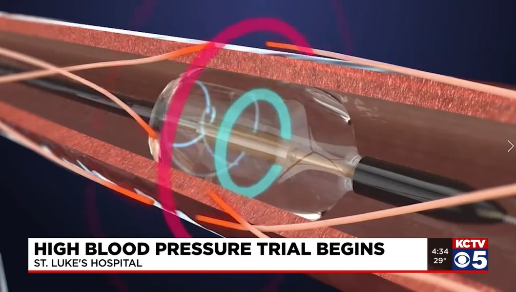 High Blood Pressure  Saint Luke's Health System