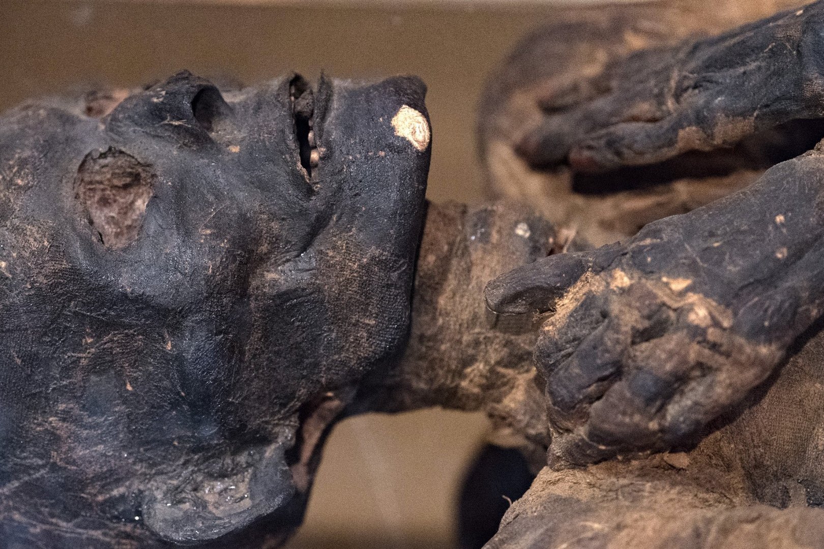 U.S. News & World Report: Mummies Study Finds Heart Disease Plagued the Ancients, Too